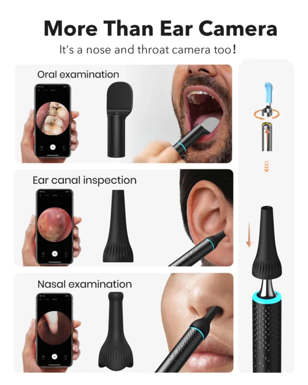 گوش پاک کن هوشمند Bebird EarSight Cleaner - Image 4