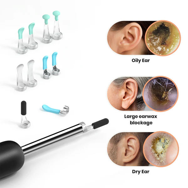 کیت سری جایگزین قاشقک گوش Bebird EarSight R1 M9 6 کیت سری جایگزین قاشقک گوش Bebird EarSight R1 M9 - Image 6